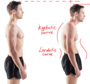 Normal Duruş, Kifoz ve Lordoz